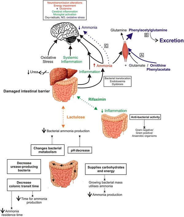 Hepatic encephalopathy: a critical current review | SpringerLink