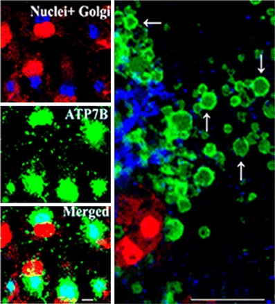 figure 11