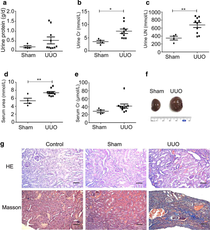 A Negative Feedback Loop Involving Nf Kb Tir8 Regulates Il 1b Induced Epithelial Myofibroblast Transdifferentiation In Human Tubular Cells Springerlink