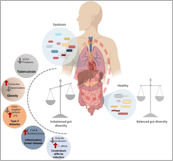 Interplay of Human Gut Microbiome in Health and Wellness | SpringerLink