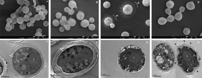 Ultrastructural Features of Cryptococcus neoformans Histone ...