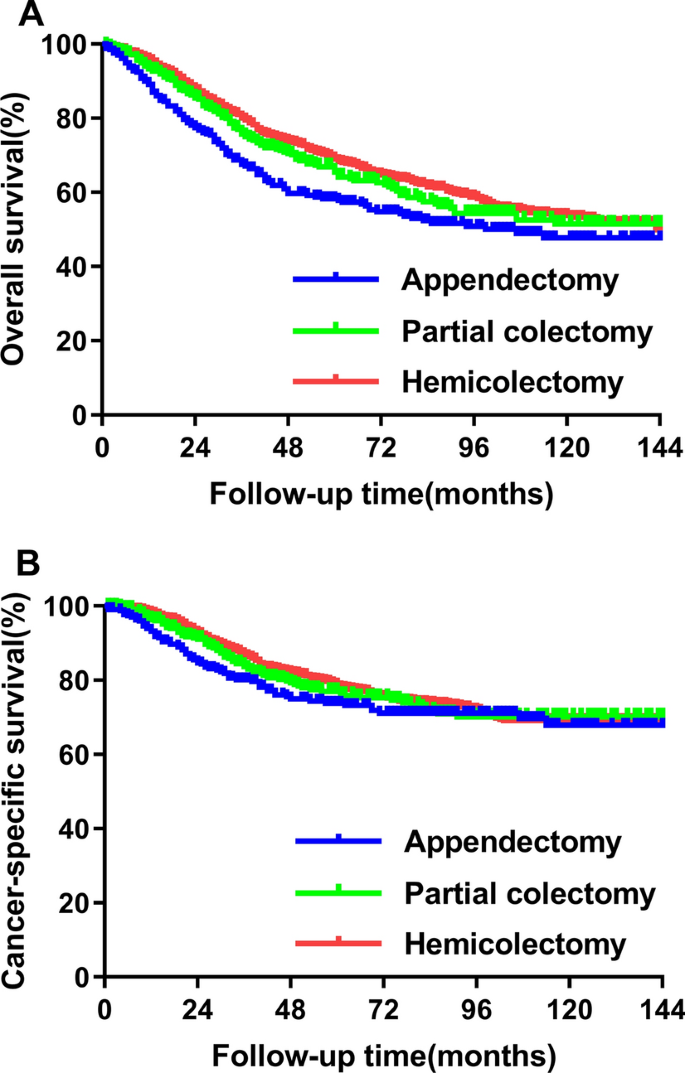 Which is the appropriate surgical procedure for appendiceal 