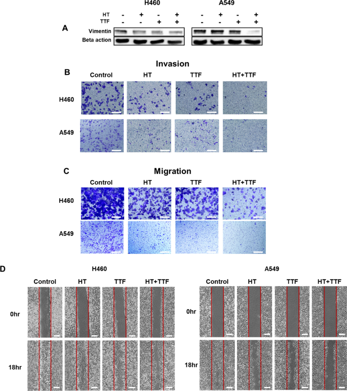 Synergistic effects of combined hyperthermia and electric fields