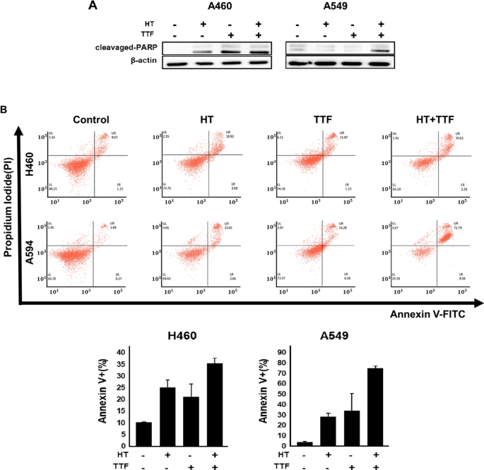 Synergistic effects of combined hyperthermia and electric fields
