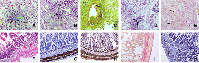 A Diagnostic Conundrum A Rare Cause Of Abdominal Distension In A