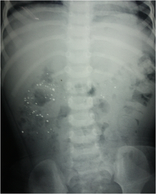mercury exposure x-ray pictures mercury exposure x-ray pictures