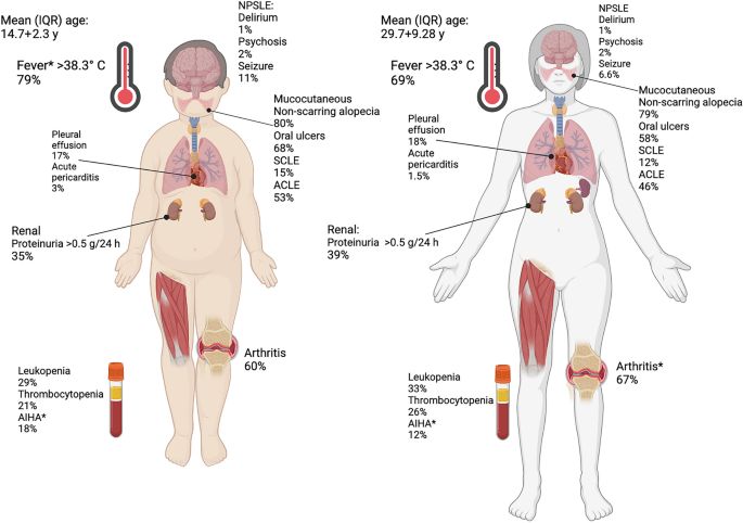 Understanding Lupus in Children