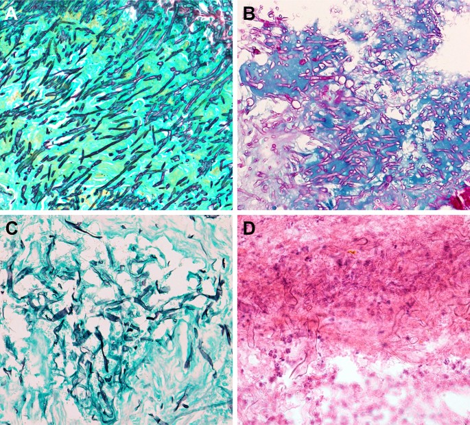 gms stain gms stain