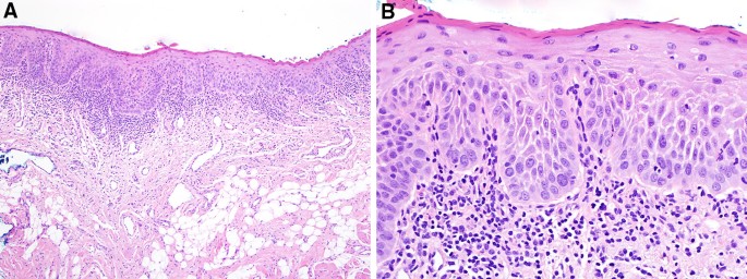 figure 26