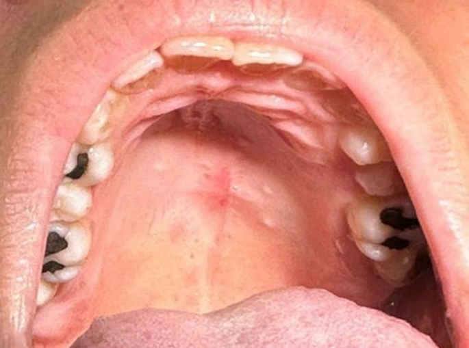 melanotic macule lip pictures A collection of resources for RACGP exams / Next Gen GP Text Book / live  webinars / AKT and KFP questions