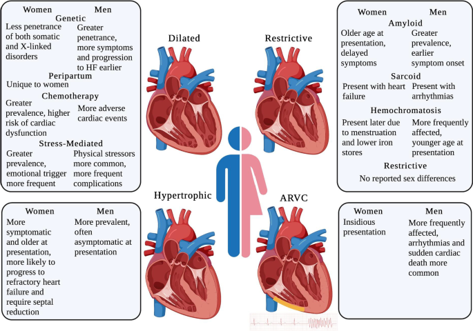 Sex Differences in Cardiomyopathy | SpringerLink