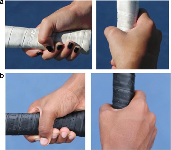 Hand and Wrist Injuries in Tennis Players | SpringerLink
