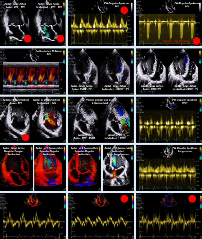 Manual zur Indikation und Durchführung der Echokardiographie – Update 2020  der Deutschen Gesellschaft für Kardiologie | SpringerLink