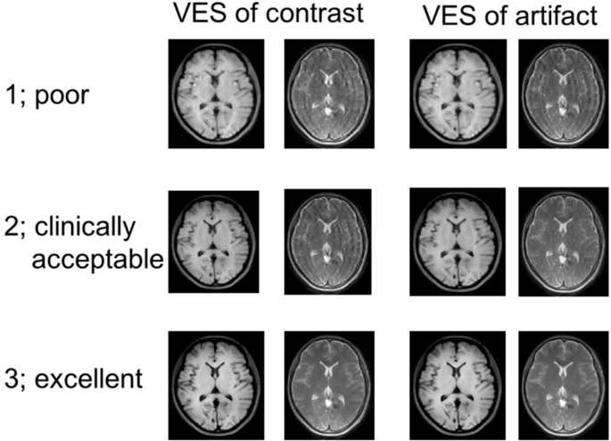 Comparison of image quality evaluation methods for magnetic resonance ...