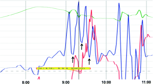 figure 9