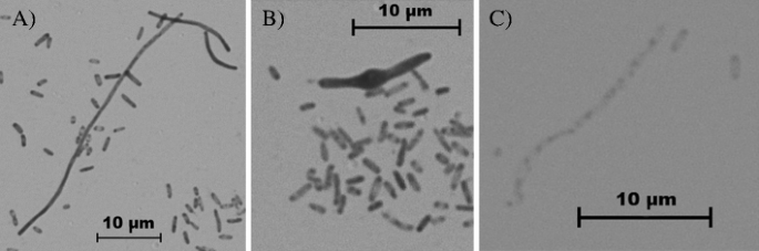 Effect Of Asiatic And Ursolic Acids On Morphology Hydrophobicity And Adhesion Of Upecs To Uroepithelial Cells Springerlink Effect Of Asiatic And Ursolic Acids On Morphology Hydrophobicity And Adhesion Of Upecs To Uroepithelial Cells Springerlink