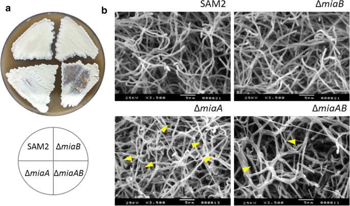 Genetic analysis of Streptomyces albus J1074 mia mutants suggests complex relationships between post-transcriptional tRNAXXA modifications and physiological traits | Folia Microbiologica