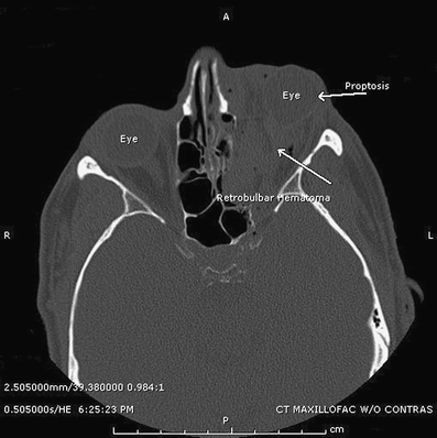 figure c