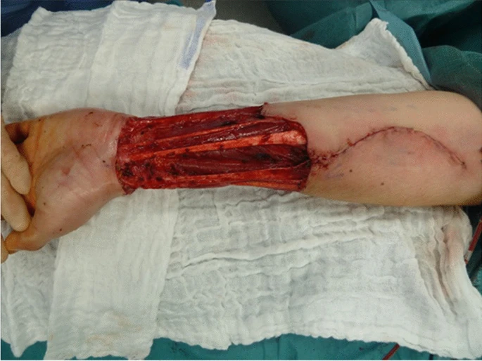 [Image: 12262_2023_3705_Fig1_HTML.jpg?as=webp]