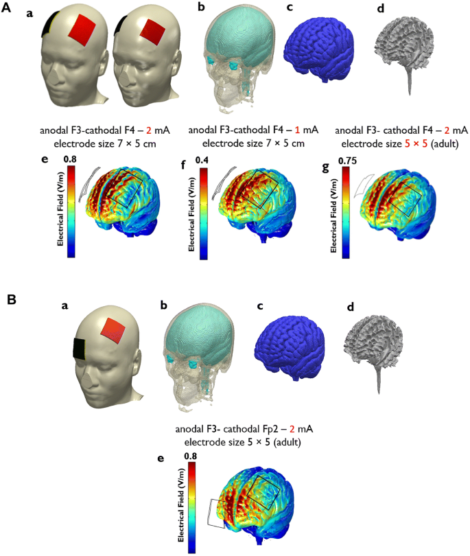 Transcranial direct current stimulation (tDCS) combined with cognitive  training in adolescent boys with ADHD: a double-blind, randomised,  sham-controlled trial, Psychological Medicine