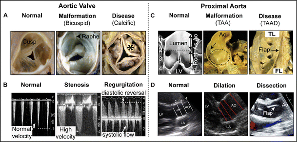 Review Of Molecular And Mechanical Interactions In The Aortic