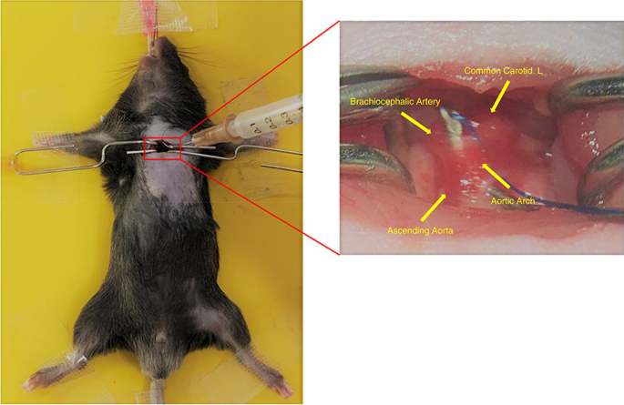 A New Minimally Invasive Method of Transverse Aortic Constriction in Mice |  SpringerLink