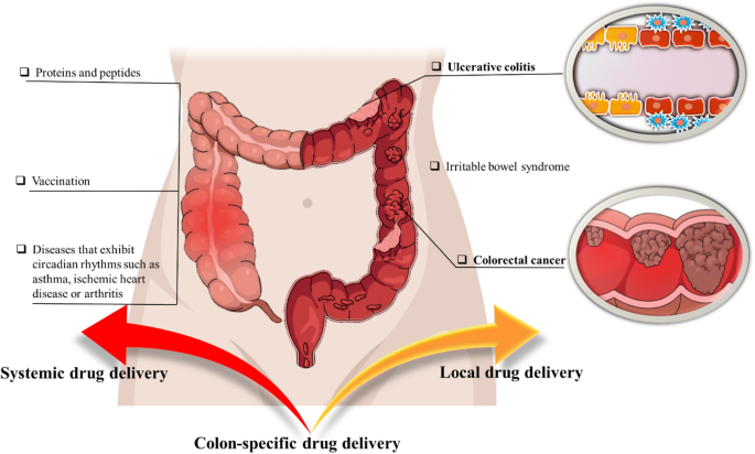 Colon перевод. Colon view тест. Colon ulterin. GD Colon паук. Colon Gydromat.