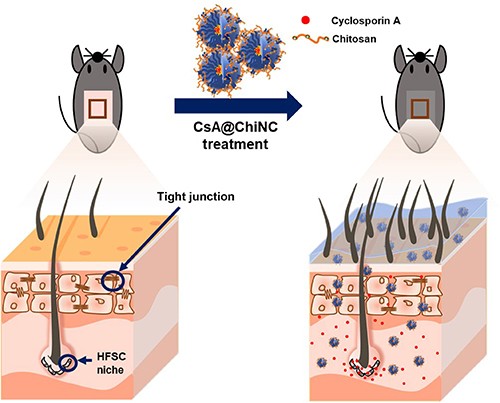 A novel chitosan nanocapsule for enhanced skin penetration of cyclosporin A  and effective hair growth in vivo | SpringerLink