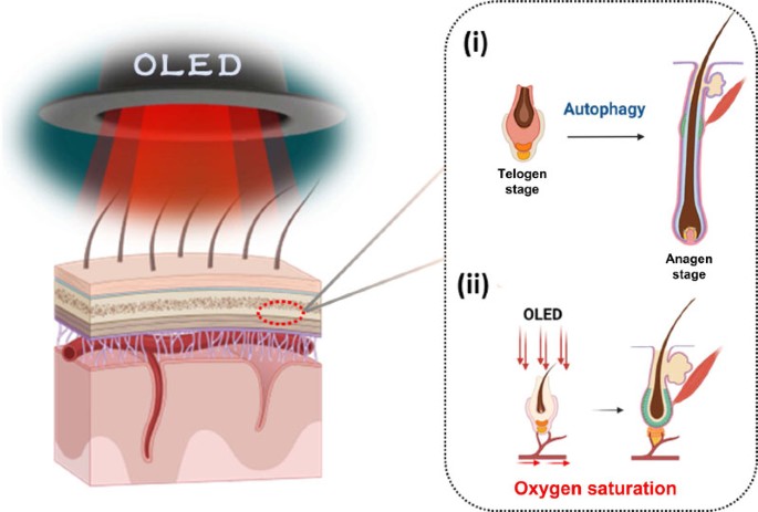 Photobiomodulation Treatment