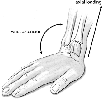 White Paper: functionality and efficacy of wrist protectors in ...