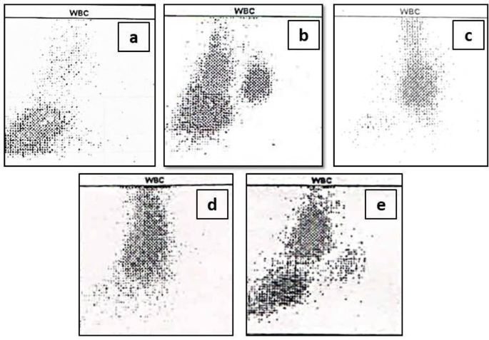 Wbc Scan Graph Utility of WBC Scatterplots and Suspect Flags Generated by Beckman ...