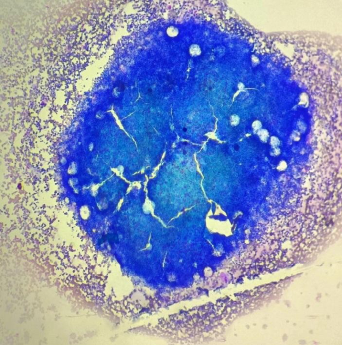 Age-Associated Decline in Bone Marrow CD34⁺ Hematopoietic Stem Cells: A ...