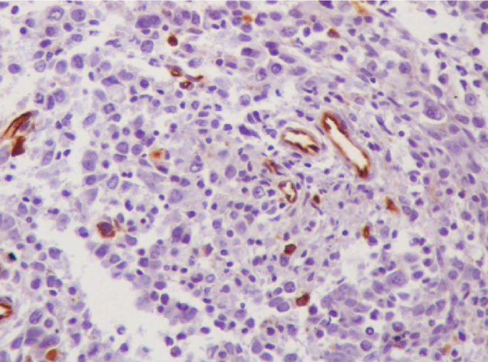 Age-Associated Decline in Bone Marrow CD34⁺ Hematopoietic Stem Cells: A ...