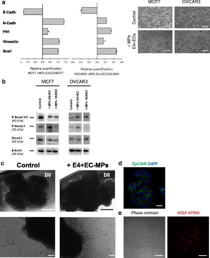 PDF) Abstract A74: Microparticles mediate cross-talk between tumoral and  endothelial cells and promote the constitution of an angiocrine  pro-metastatic niche through Arf6 up regulation