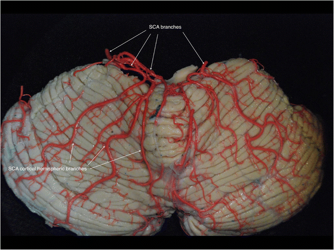 figure 15