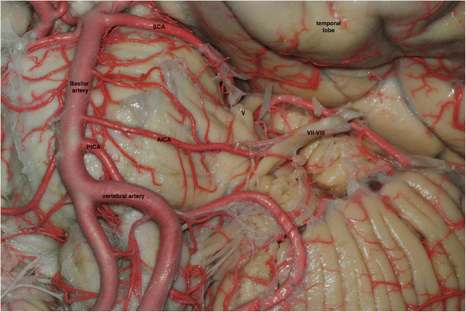 figure 18