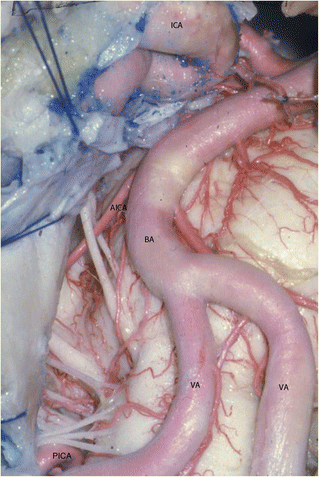 figure 21