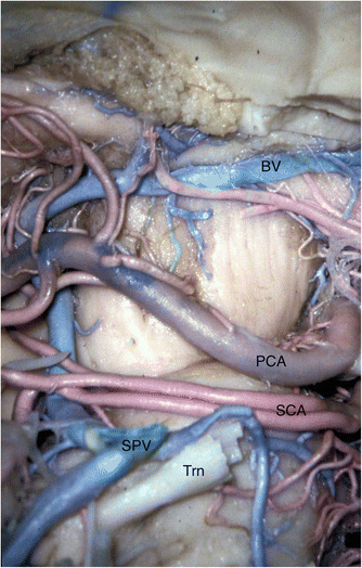 figure 52