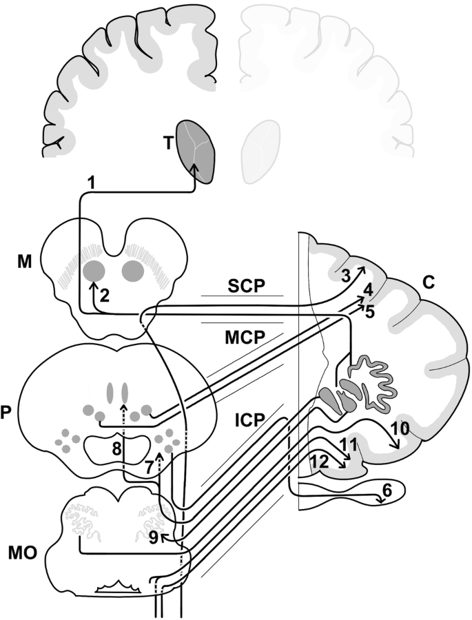 The Role Of The Cerebellum In Huntington S Disease A Systematic Review Springerlink