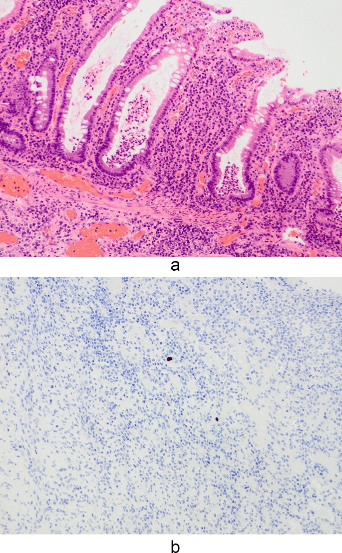 bpc 157 ulcerative colitis reddit Stable gastric pentadecapeptide BPC 157 heals rat colovesical fistula main image 1