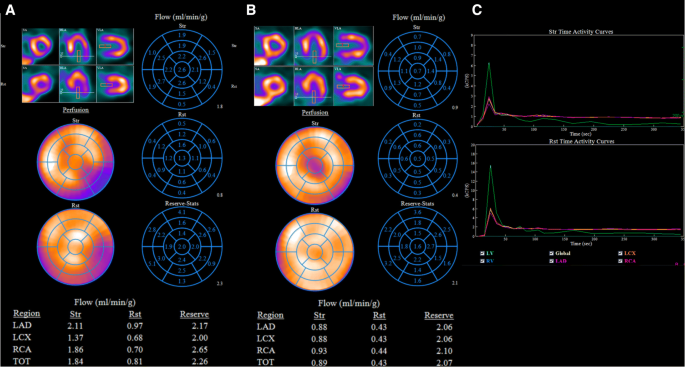 impact of attenuation correction for czt spect measurement of myocardial blood flow springerlink impact of attenuation correction for czt spect measurement of myocardial blood flow springerlink