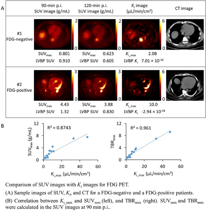 Abstracts of Original Contributions ASNC2020 The 25th Annual Scientific  Session of the American Society of Nuclear Cardiology