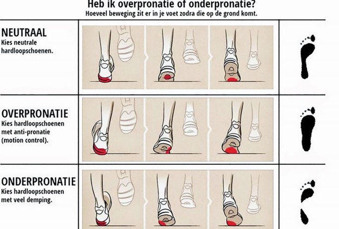 Onderpronatie | Store museusolsona.cat