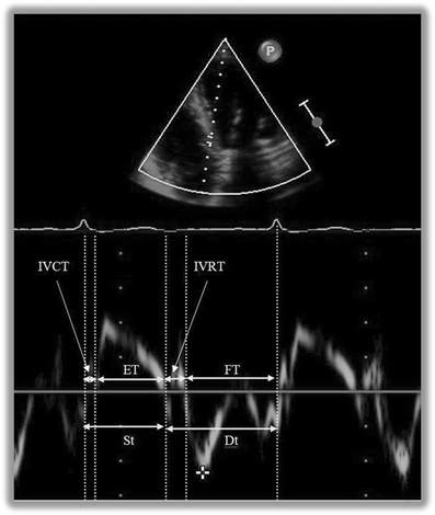 е е эхокардиография
