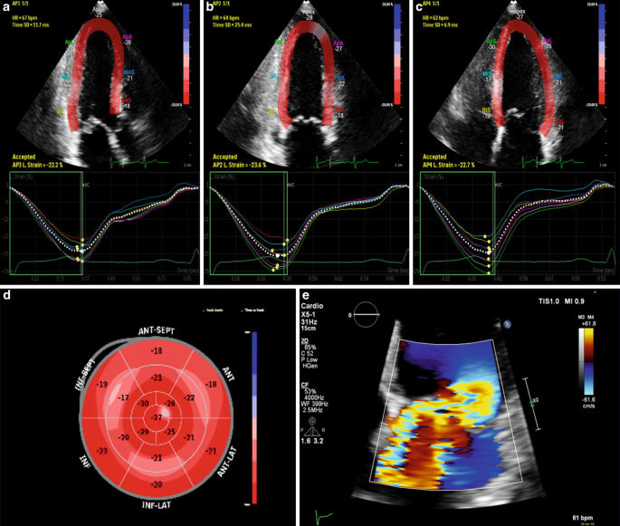 Global longitudinal strain to predict left ventricular dysfunction in  asymptomatic patients with severe mitral valve regurgitation: literature  review