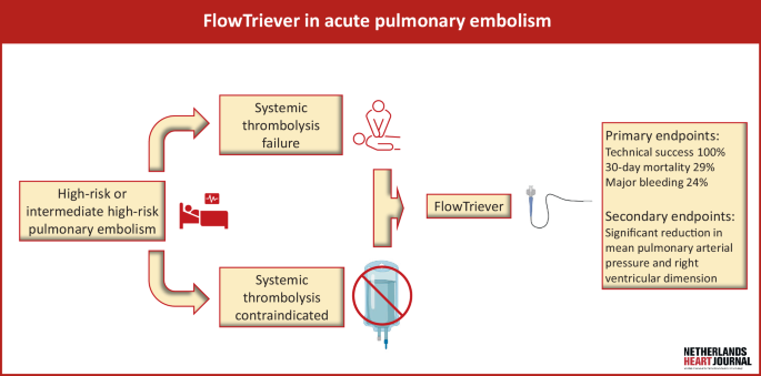Catheter-directed therapy with the FlowTriever system for intermediate ...