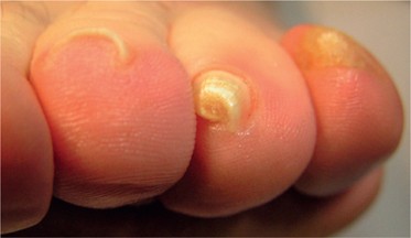 Hoe Knip Ik Deze Nagels Goed Springerlink