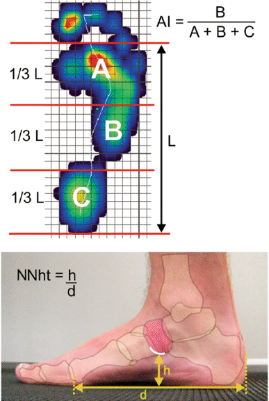diagnostice de boli ale articulațiilor piciorului durere în jurul tratamentului articulației genunchiului