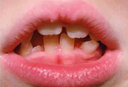 Duimzuigen Springerlink