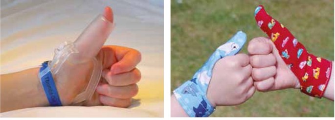 Duimzuigen Springerlink